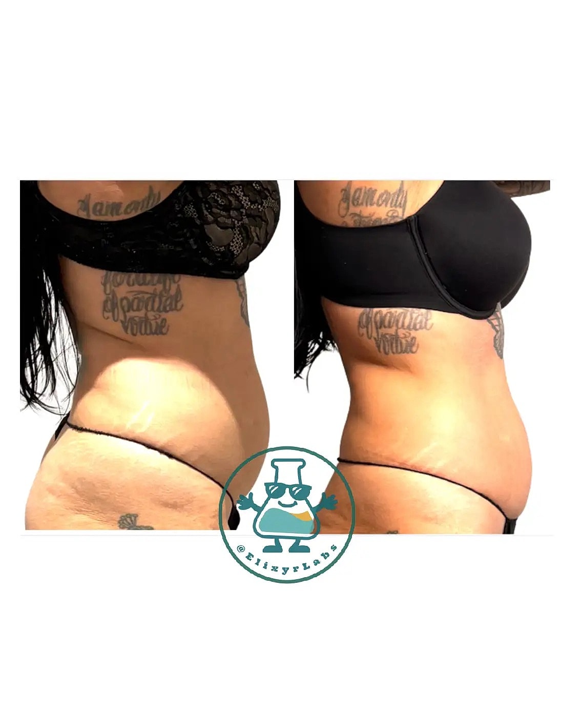 T Shape Before & After