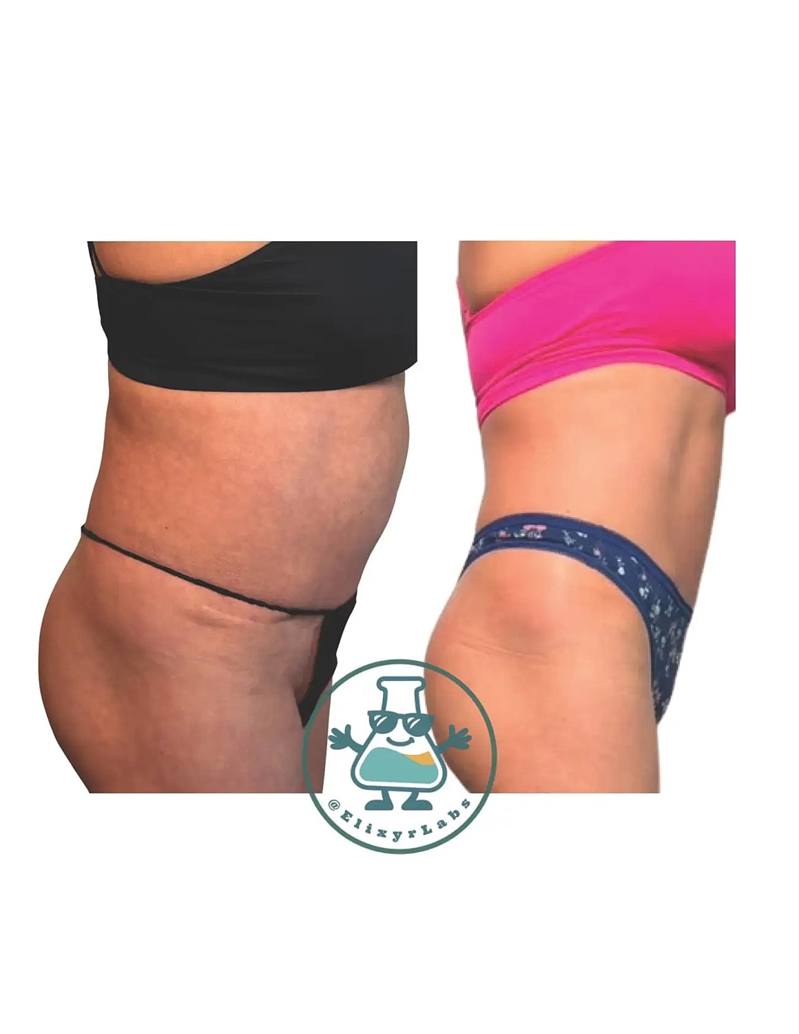 T Shape Before & After