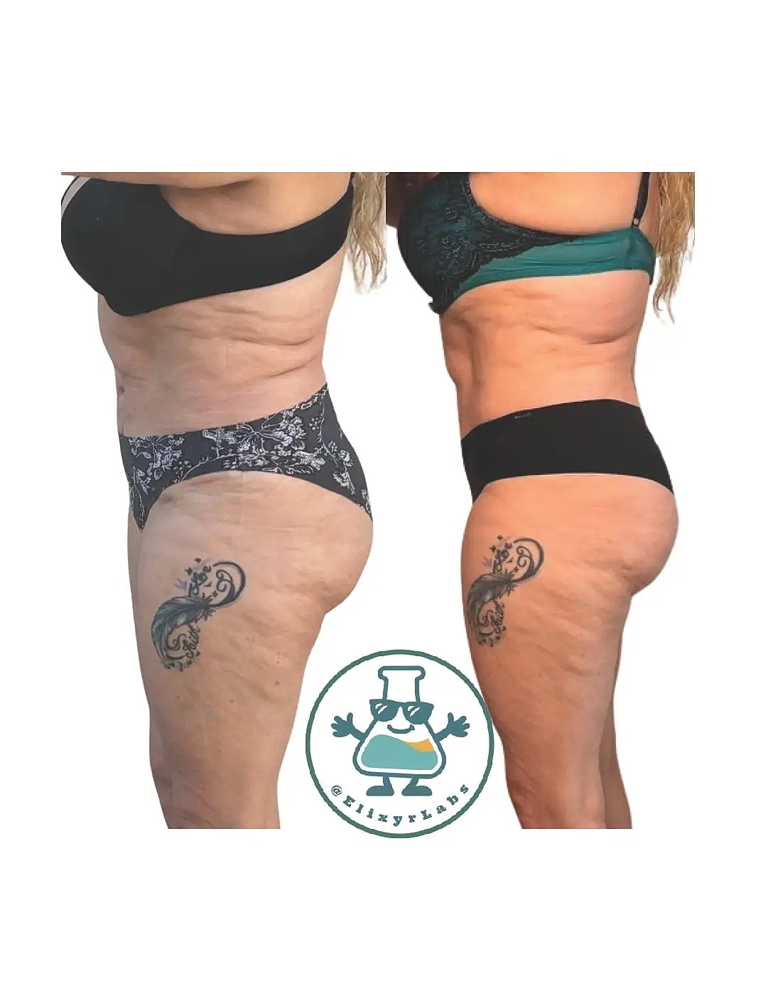 T Shape Before & After