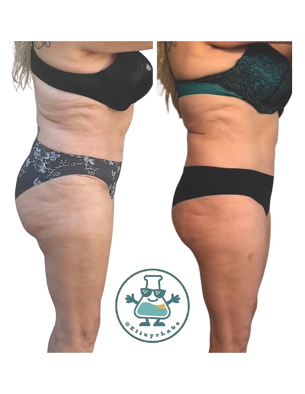 T Shape Before & After