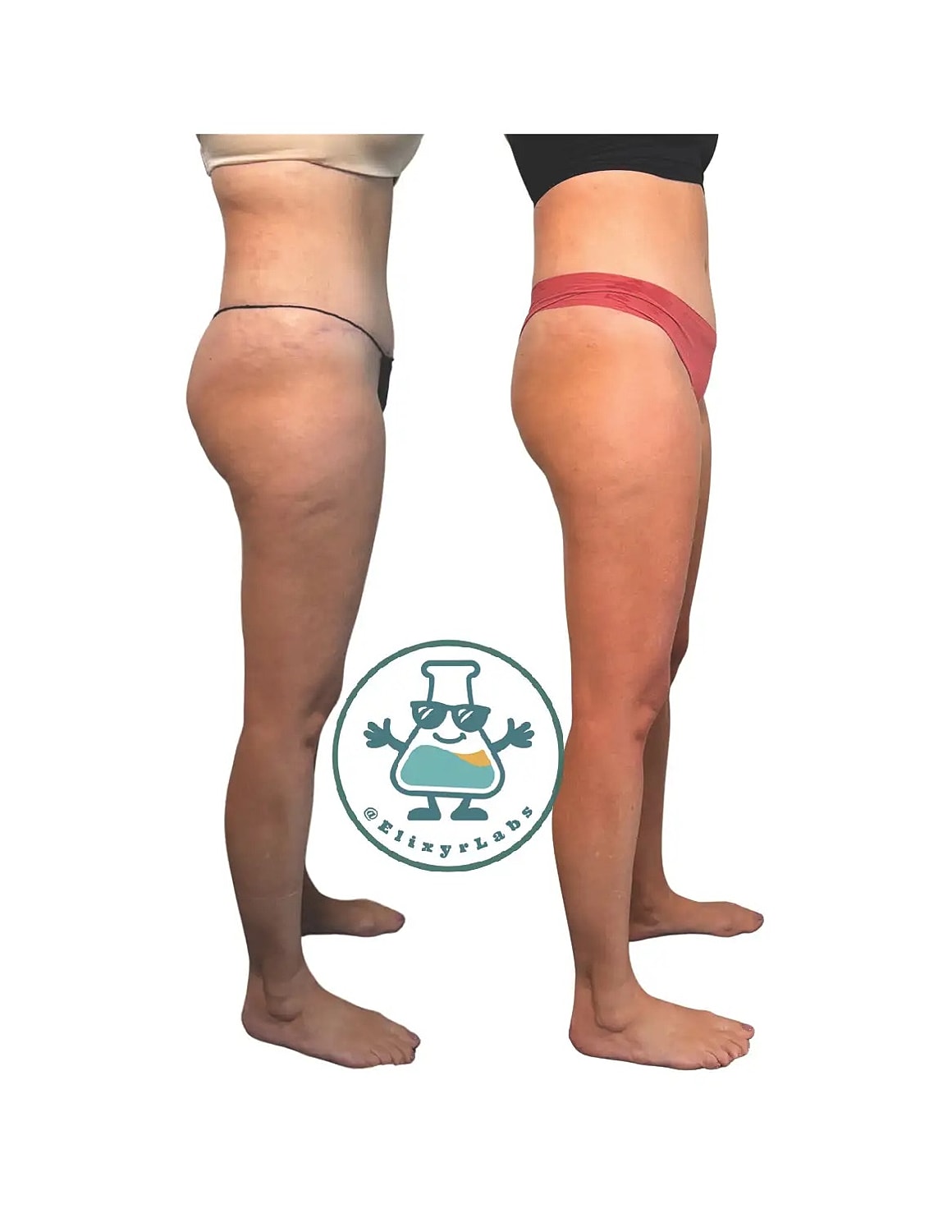 T Shape Before & After