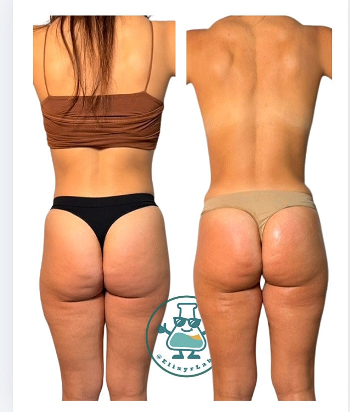 Comparison of body shapes with different underwear styles.