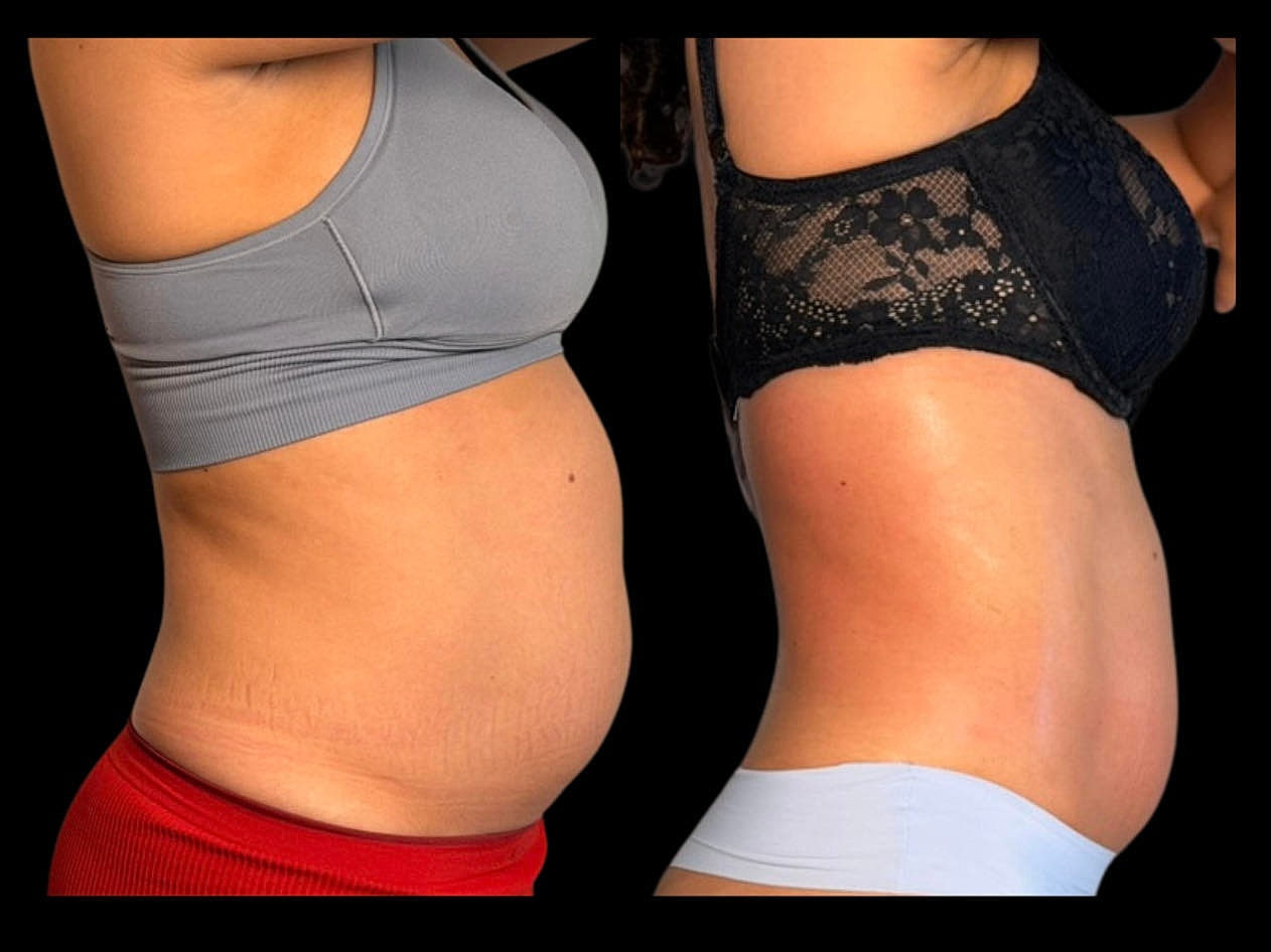 Comparison of two different body shapes.