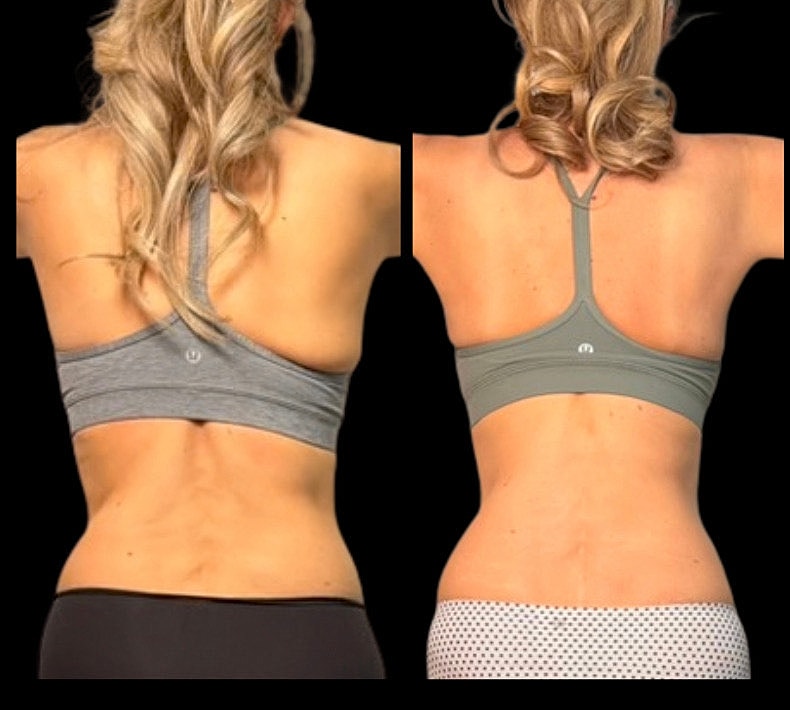 Side-by-side comparison of two sports bras.