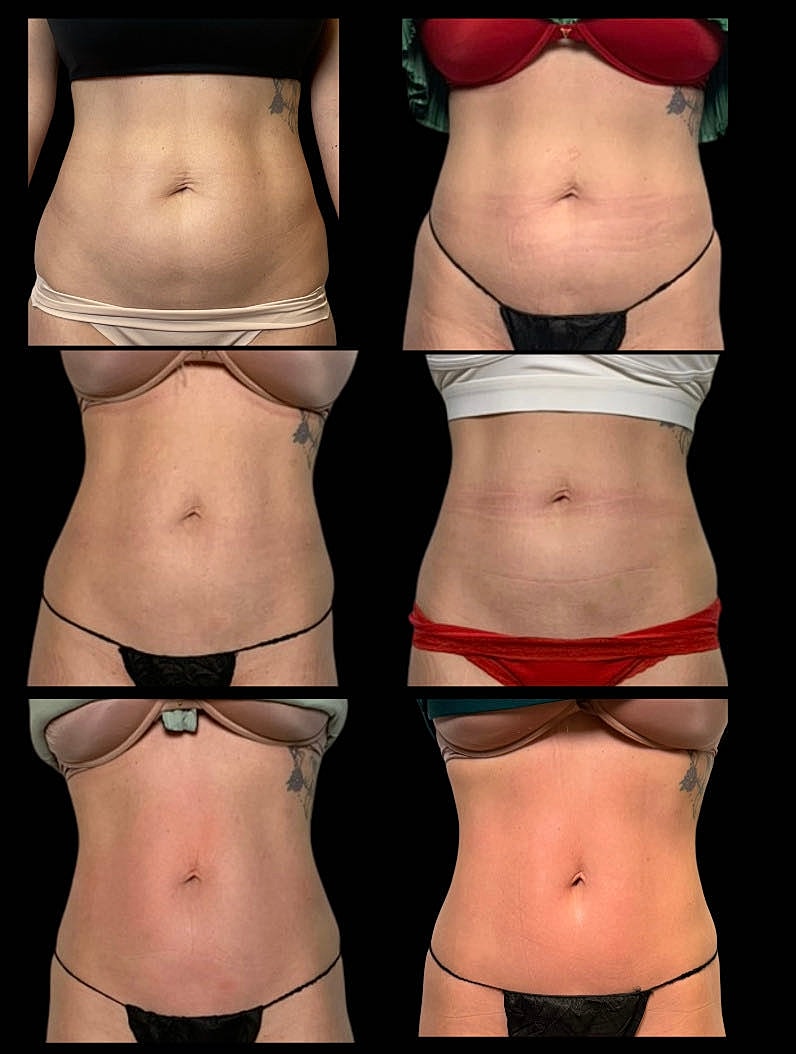 Six images of different women's midriffs.