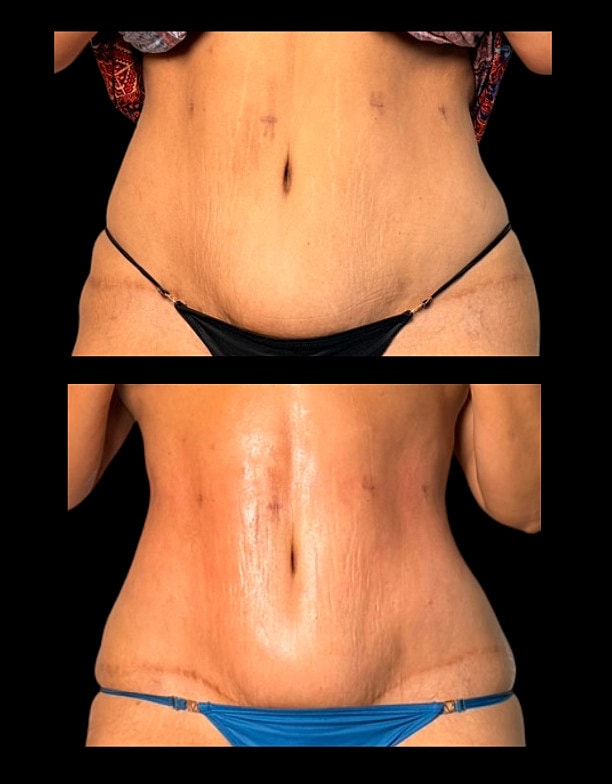 Before and after body transformation images.